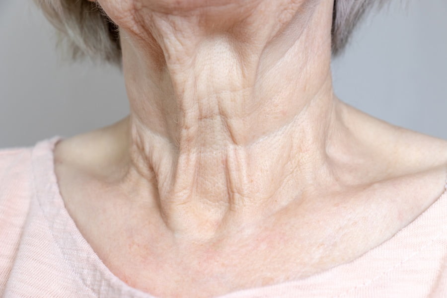 skin-concerns-neck-lines-the-london-skin-clinic